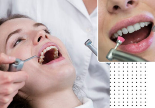 Dental Routine Examination - DenTru New Gurgaon