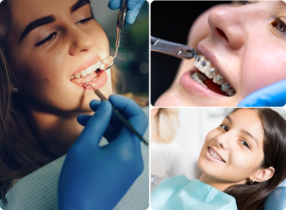 Orthodontic Smile Care