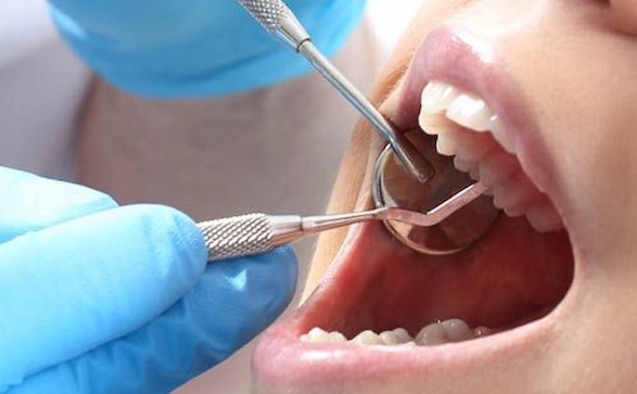 Root Canal Treatment
