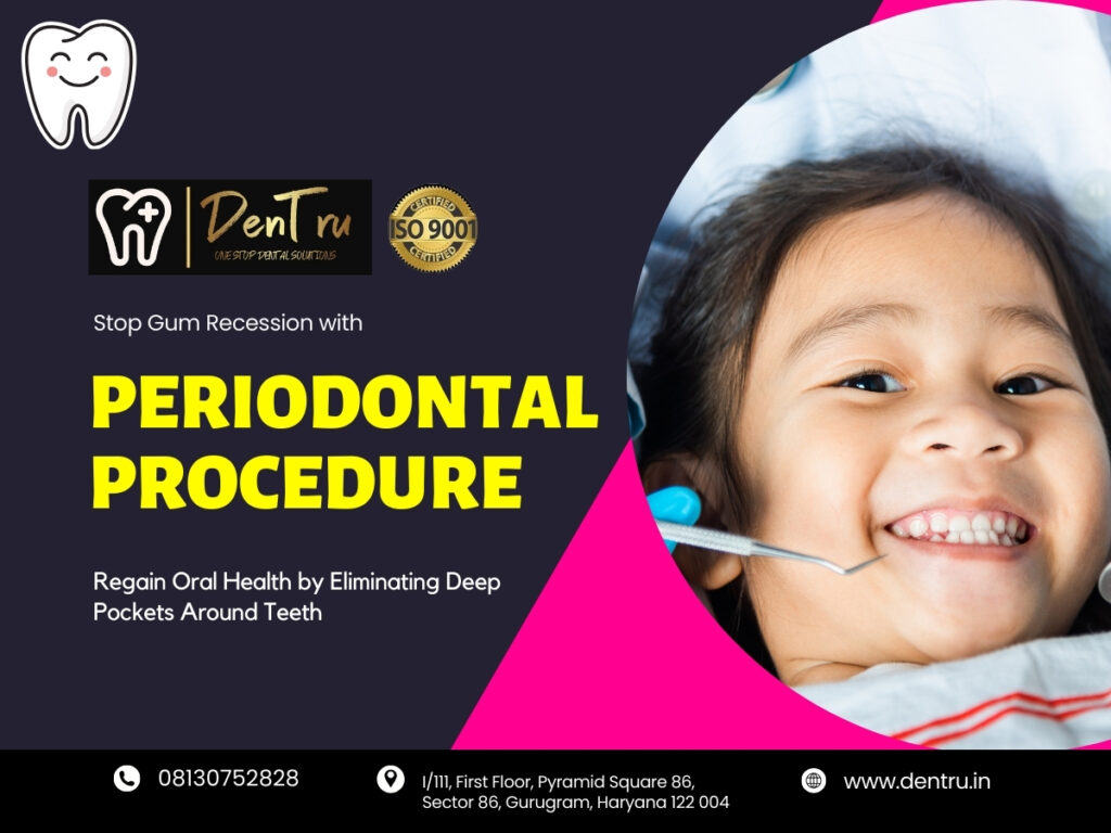 Periodontal Procedure in Gurgaon