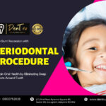 Periodontal Procedure in Gurgaon