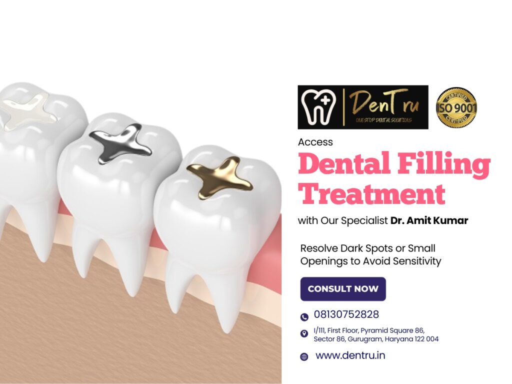 Dental Filling Treatment at Dentru