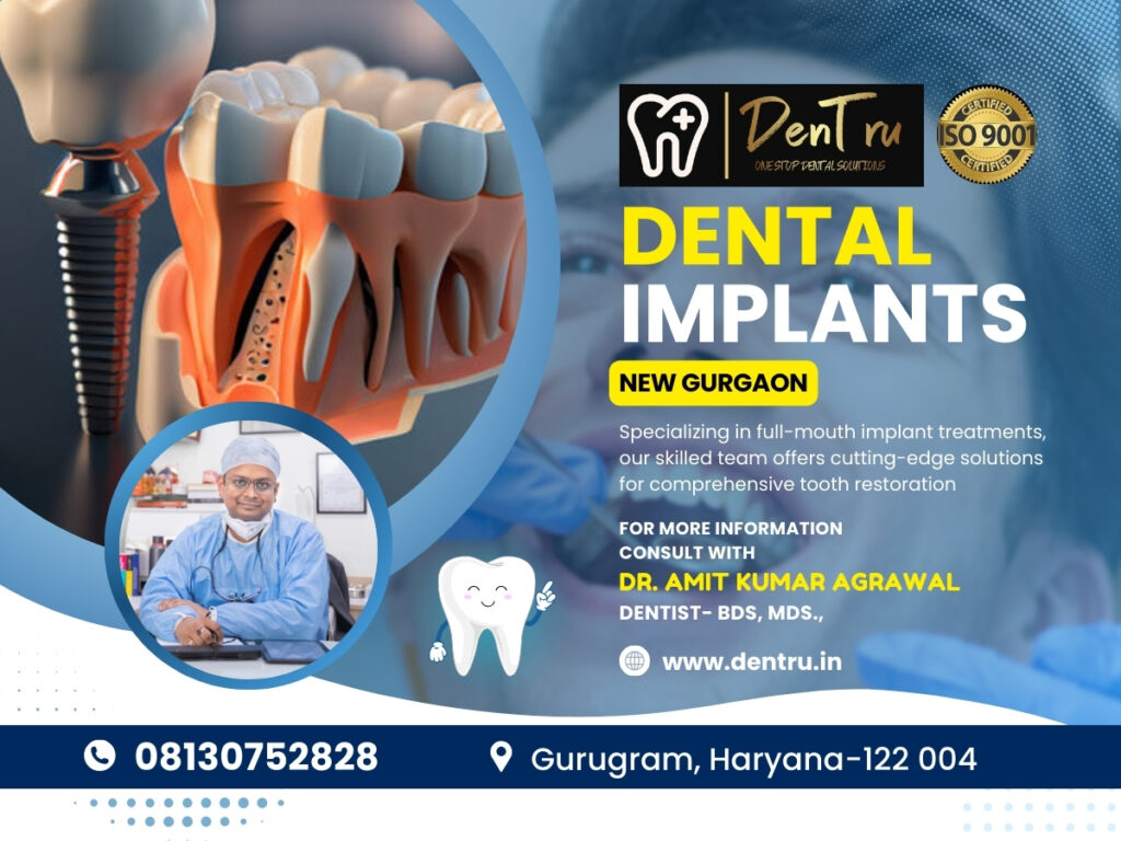 Dental Implant Treatment in Gurgaon