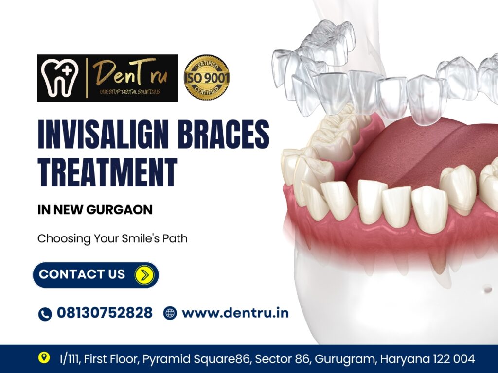 Invisalign Solutions for Straight Teeth at Dentru in Gurgaon