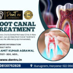 Best Root Canal Treatment in Gurgaon