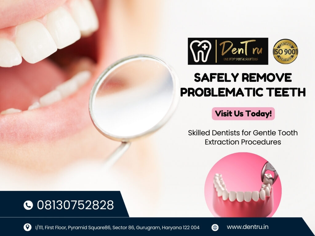 Wisdom teeth removal options in Gurgaon