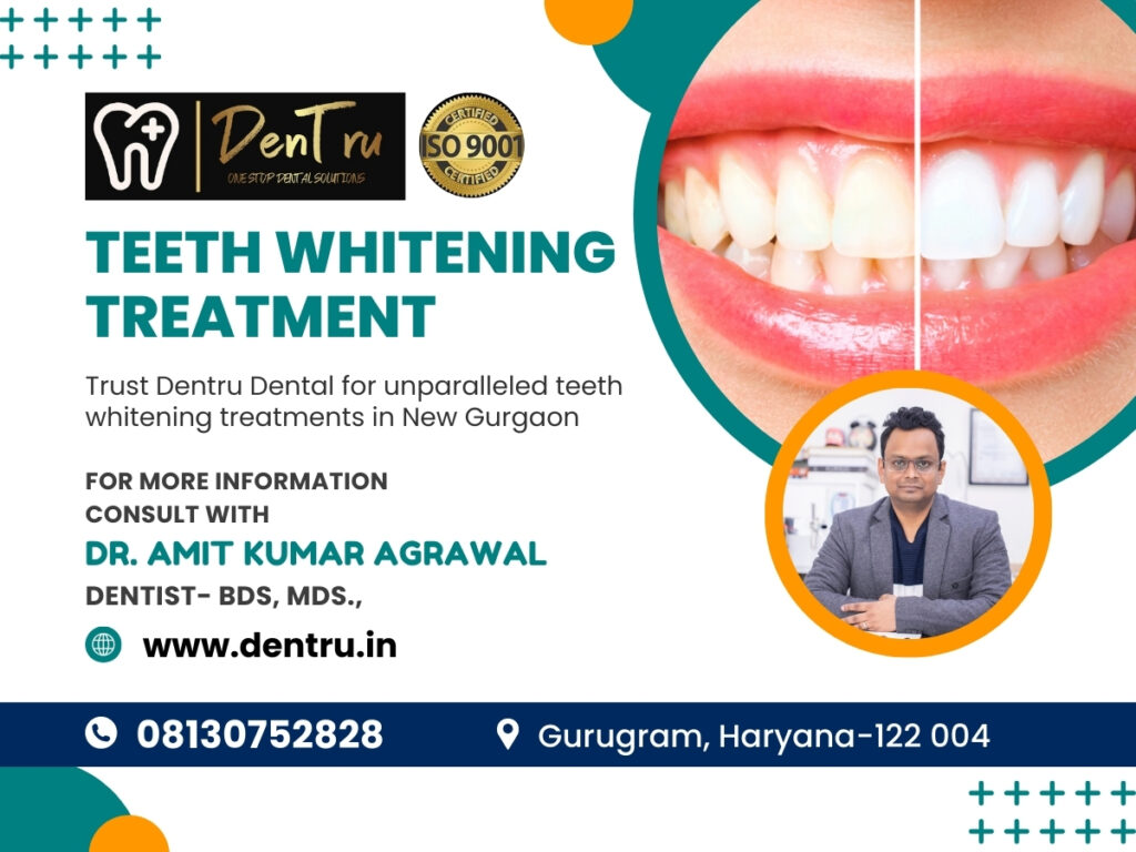 Best Teeth whitening treatment at Dentru