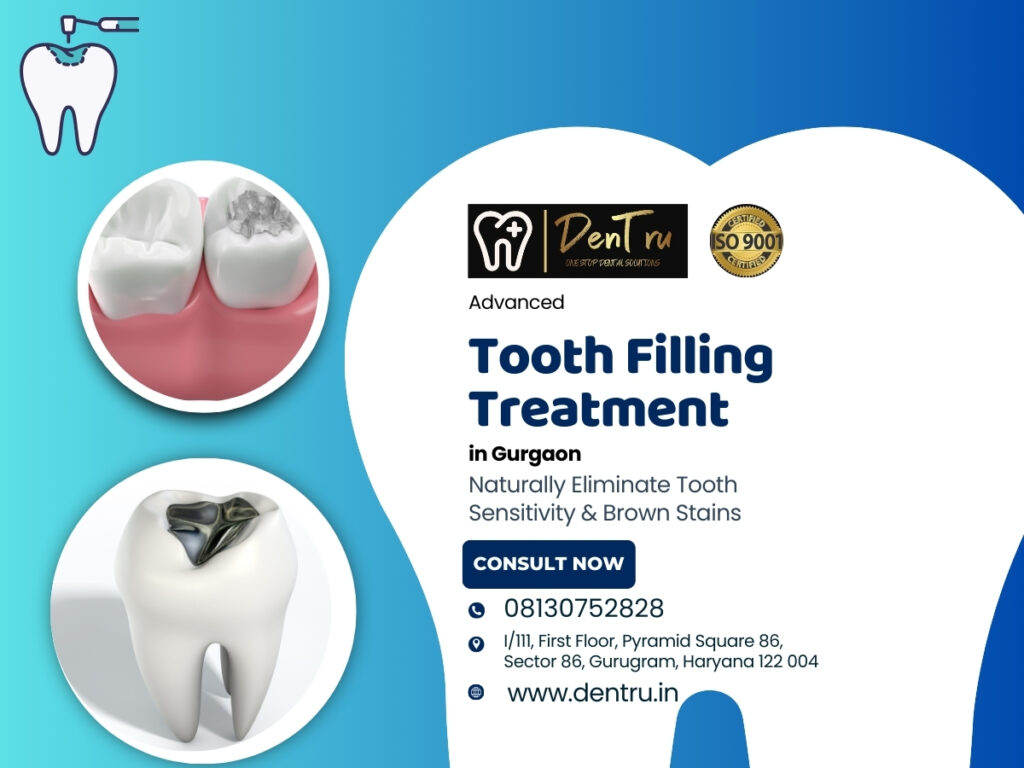 Tooth filling treatment at Dentru