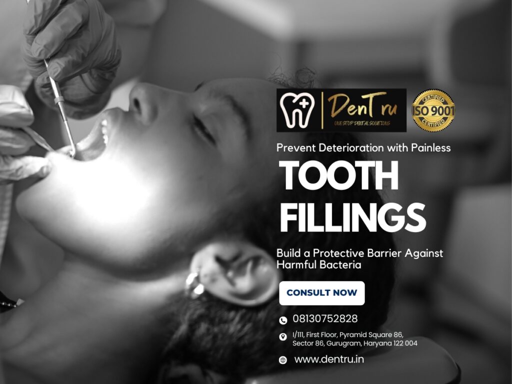 Dental Filling Treatment in Gurgaon