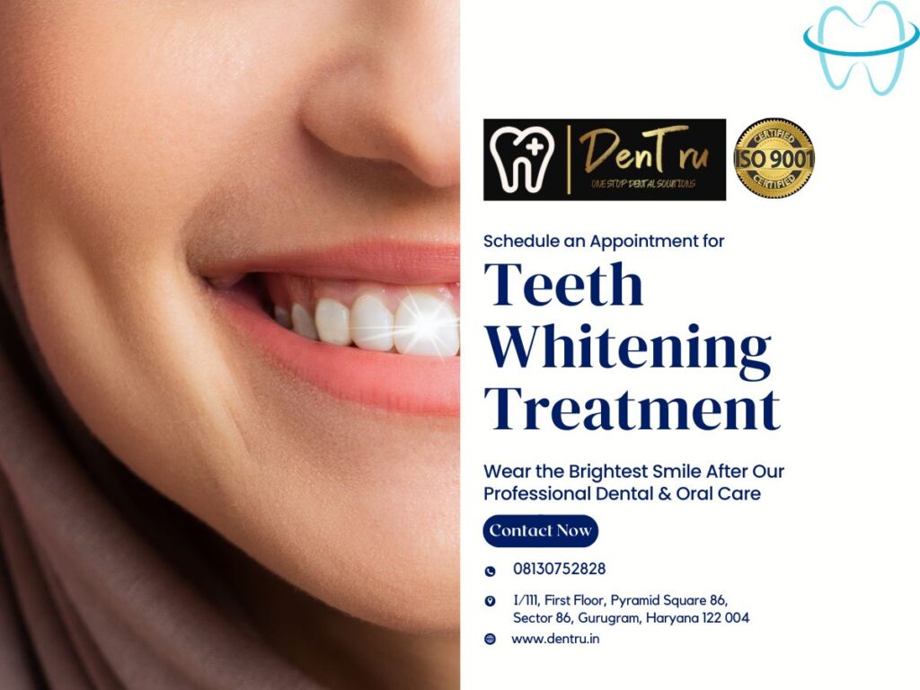 Teeth Whitening Dental Treatment in Gurgaon