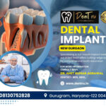 Advanced Dental Implant Techniques in Gurgaon