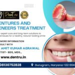 Crowns vs. Veneers – Restoration Choices in Gurgaon