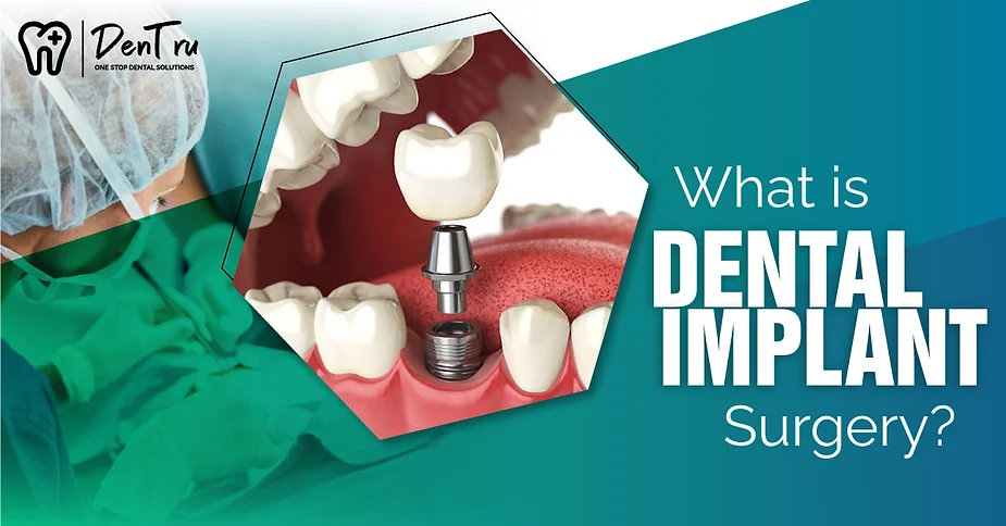 dental-implant-surgery-in-gurgaon