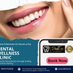 Effective Dry Mouth Treatment at Dentru in Gurgaon