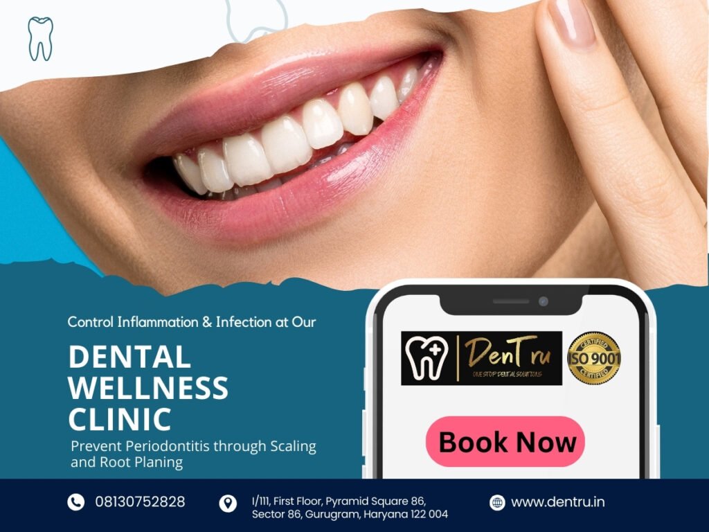 Effective Dry Mouth Treatment at Dentru in Gurgaon