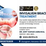Effective Solutions for Correcting Dental Alignment Issues