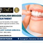 Find Your Perfect Fit - Invisalign vs. Braces