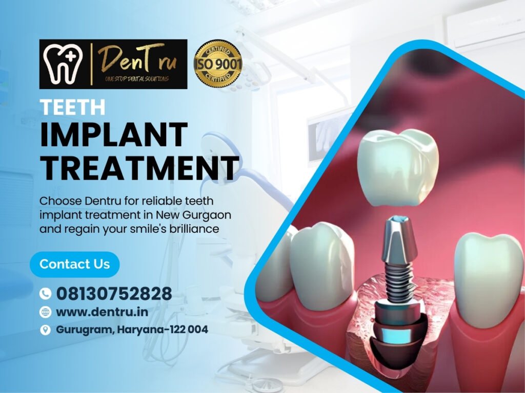 Mini Dental Implants at Dentru Clinic in Gurgaon
