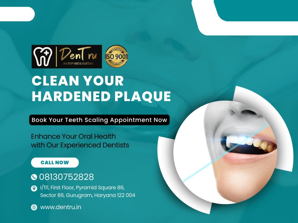 Professional Teeth Cleaning Services in Gurgaon