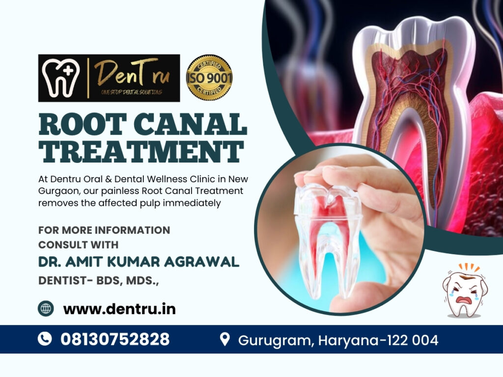 Saving Your Tooth with the Best Root Canal Treatment