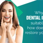 Why Dental Implants Suitable