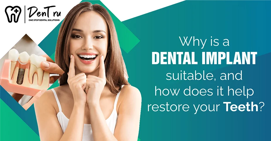 Why Dental Implants Suitable