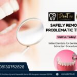 Wisdom Teeth Removal Oaptions Available In Gurgaon