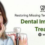 Dental Implants Treatment Care in New Gurgaon